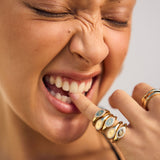 Close-up of a woman with gold rings on her fingers, pointing to her teeth.
