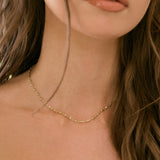Eye Romanticise You Choker